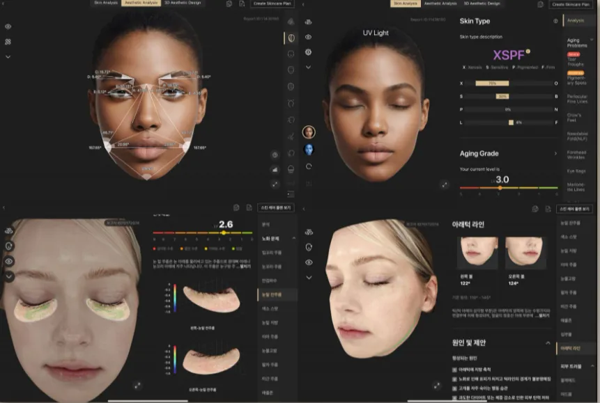 Korean facial treatment — EVE V skin analysis results