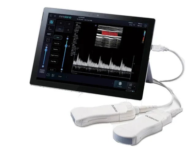 Korean facial treatment — Portable & Console Diagnostic Ultrasound portable device