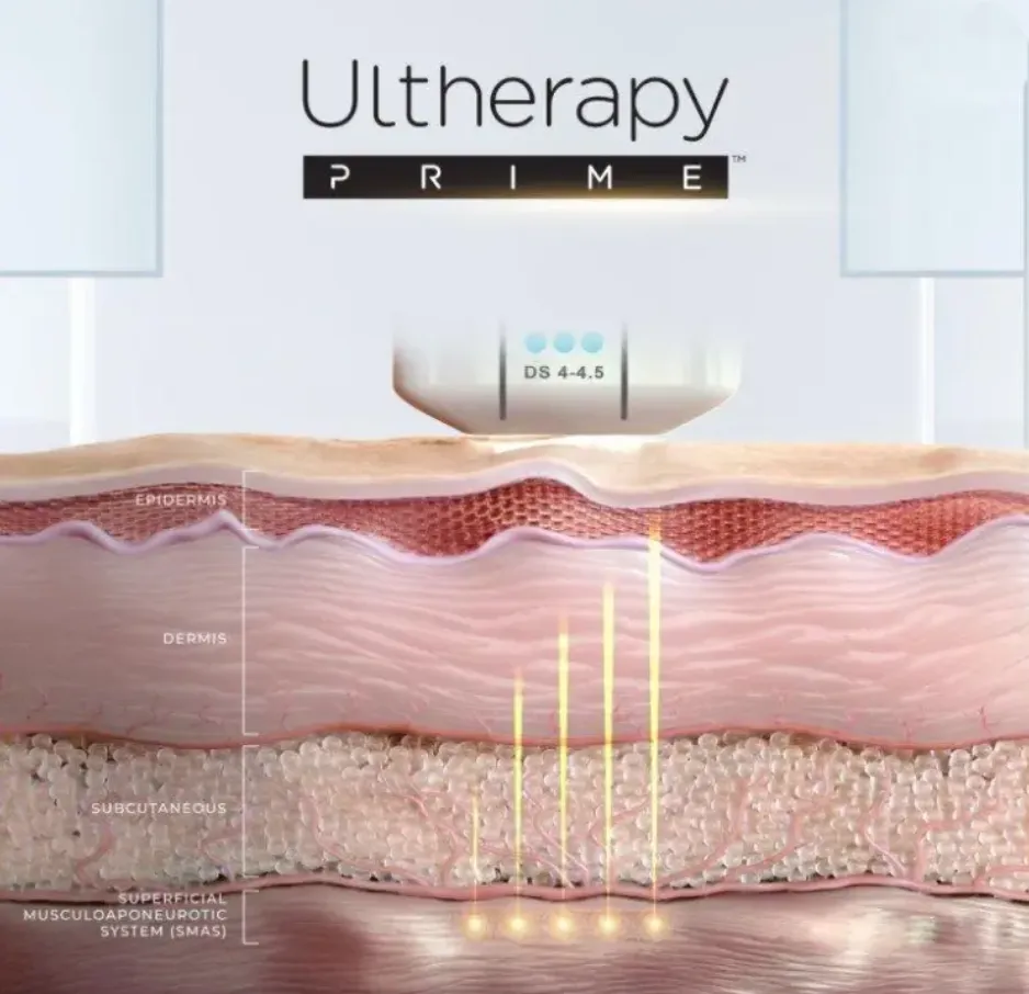 Korean facial treatment — How Ultherapy Prime works
