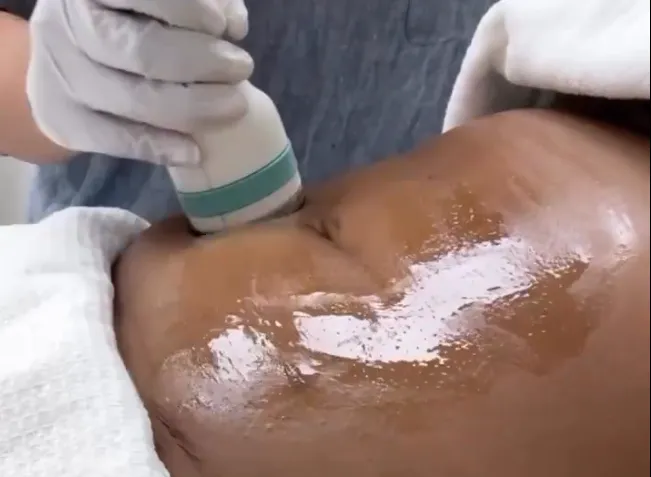 Korean facial treatment — ONDA treatment