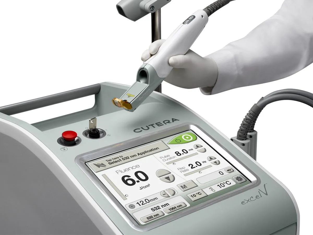 Korean facial treatment — Excel V device close-up