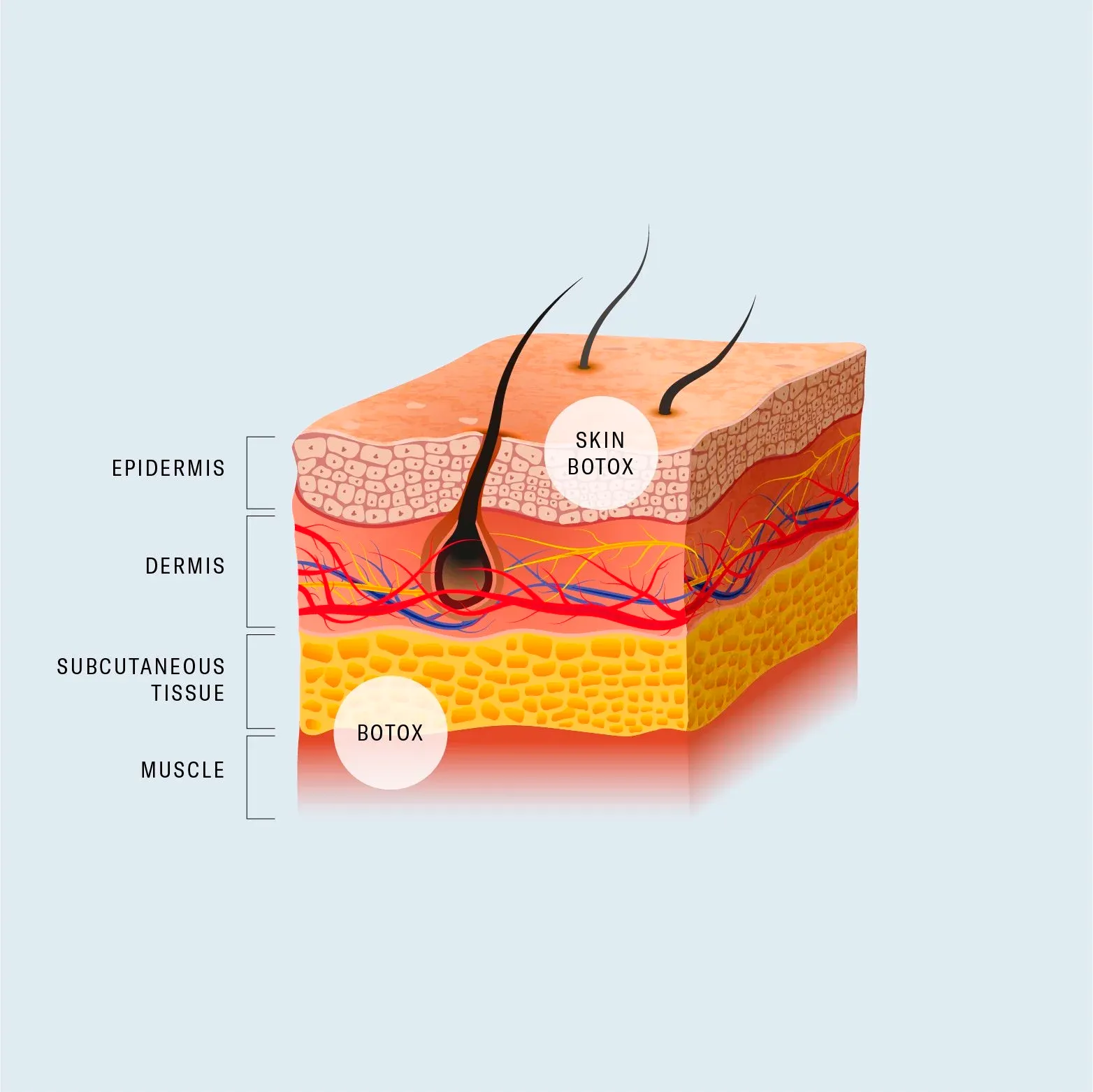 Korean facial treatment — How Skin Botox works